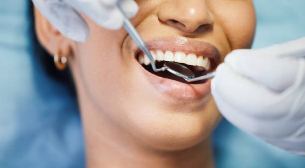 Best Pediatric Emergency Dentist in Fairlawn, VA
