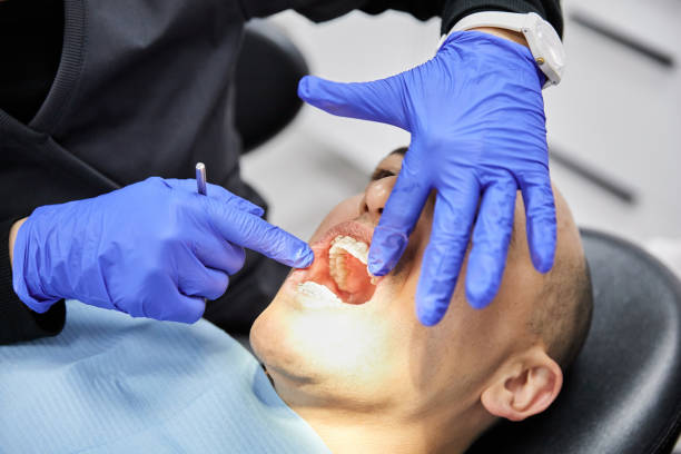 Best Emergency Dental Care for Broken or Chipped Teeth in Fairlawn, VA